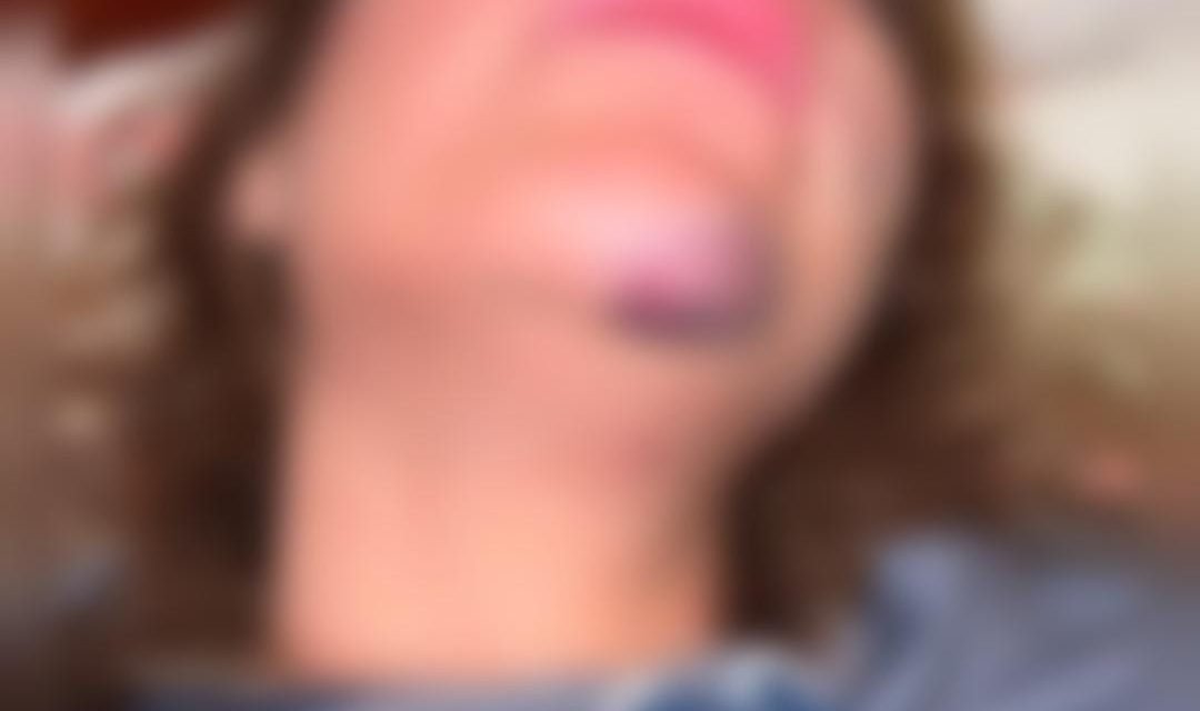 MUJER DENUNCIA BRUTAL AGRESIÓN PROPINADA POR SU EXPAREJA